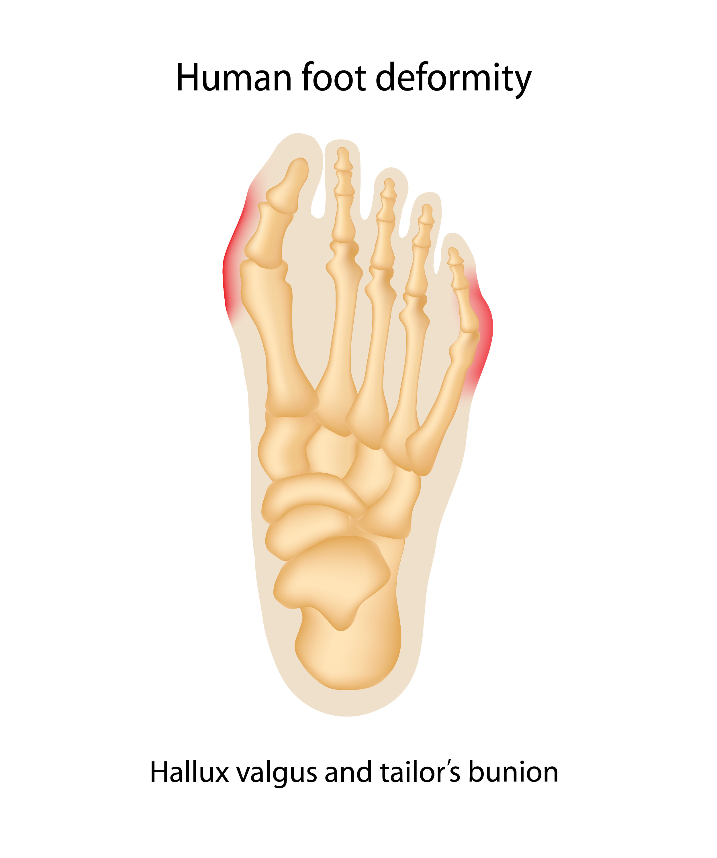 A Tribute to Our Teachers FeetCare